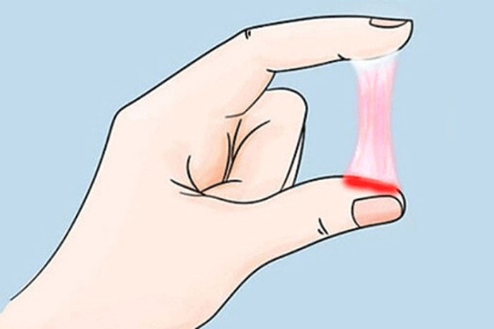 Khí hư có màu hồng nhạt là hiện tượng thường thấy trong 3 tháng đầu khi mang thai