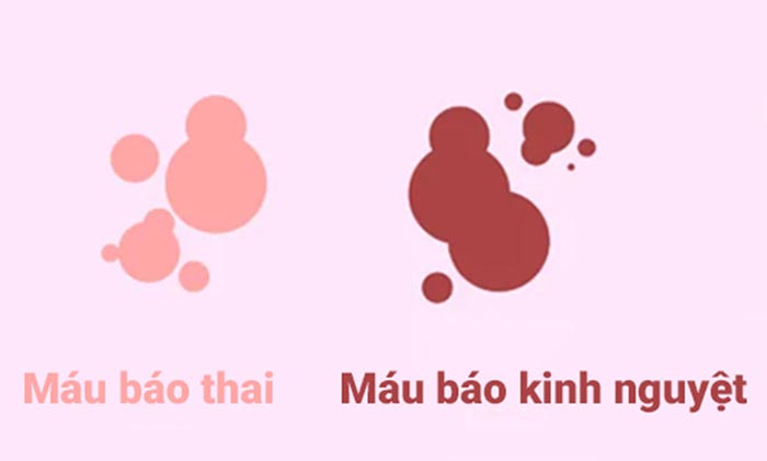 Máu báo thai thường có màu nâu nhạt hoặc màu hồng khác với màu máu báo kinh nguyệt