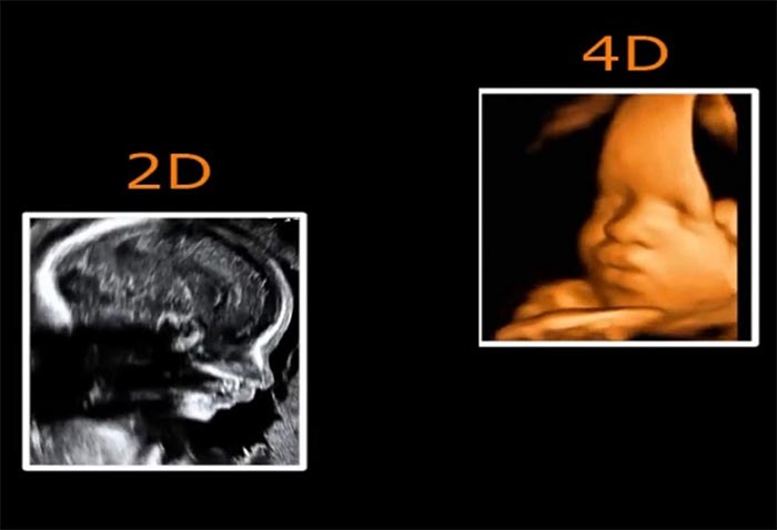 Sự khác nhau rõ rệt về mặt hình ảnh của kỹ thuật siêu âm 2D, 3D và 4D
