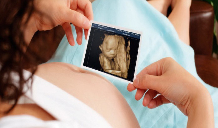 Mẹ nên thực hiện siêu âm 3D ở các mốc khám thai khuyến cáo (12, 22, 32 tuần)