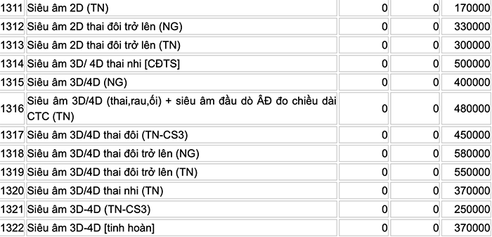 Sieu-am-4d-gia-bao-nhieu