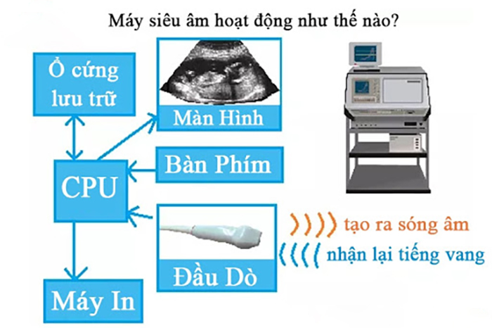 cách-thuc-hoat-dong-sieu-am