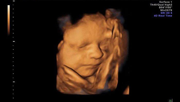 Mẹ bầu thực hiện siêu âm 4D khi muốn quan sát thai nhi rõ ràng