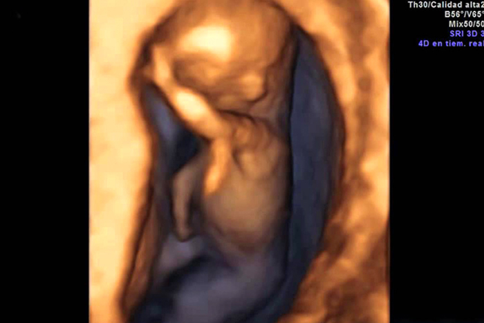 Hình ảnh thai nhi 12 tuần trên siêu âm 4D
