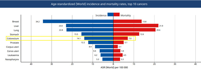 Ung thư đại tràng có tỷ lệ tử vong thấp hơn trong nhóm các ung thư thường gặp nếu được phát hiện và điều trị kịp thời