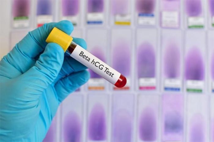 Xét nghiệm các dấu ấn sinh học thai (PAPP-A, free beta HCG) trong máu mẹ