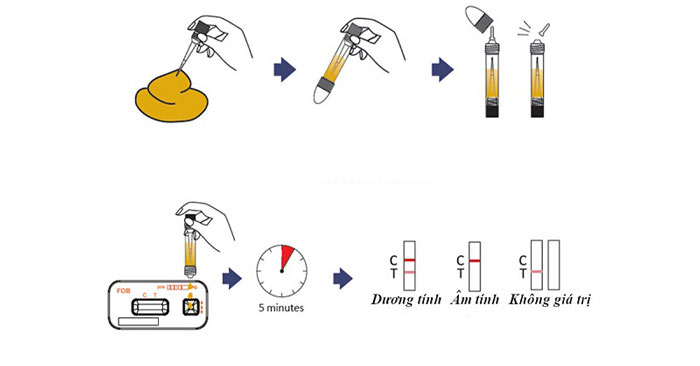 xét nghiệm phân