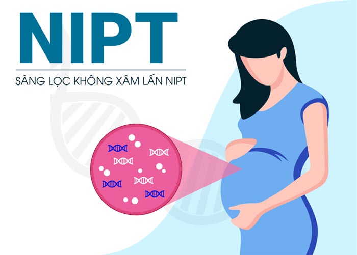 Xét nghiệm tiền sản NIPT chẩn đoán bệnh Down có độ chính xác lên đến 99,99%