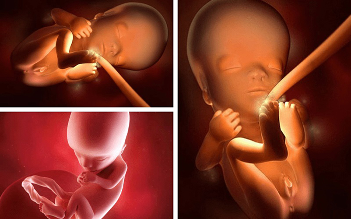 Hình ảnh siêu âm thai nhi là bé gái khi 12 tuần