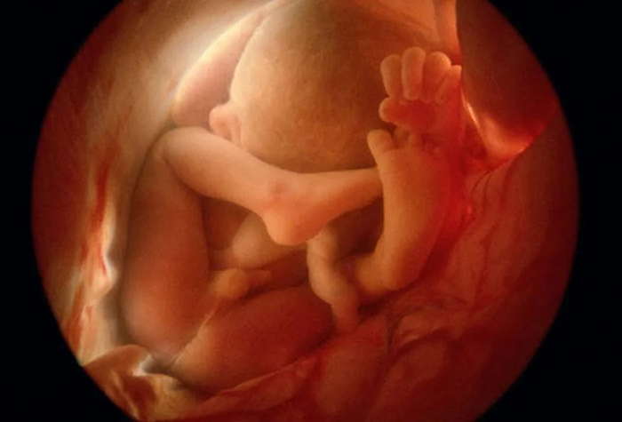 Hình ảnh siêu âm thai nhi là bé trai khi 12 tuần