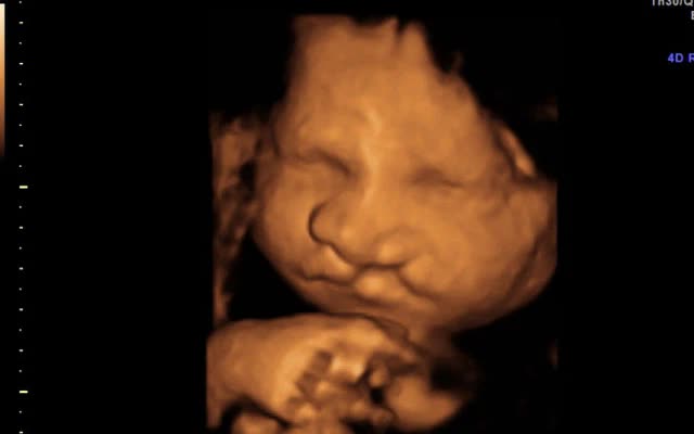 Siêu âm 4D thai: Hãy khám phá siêu âm 4D thai đầy kỳ diệu và thú vị. Bạn sẽ được chứng kiến hình ảnh thai nhi một cách rõ nét và sắc nét hơn bao giờ hết, nhưng đặc biệt hơn hết là cảm nhận được những chuyển động đầy sống động của bé yêu trong bụng của mẹ.