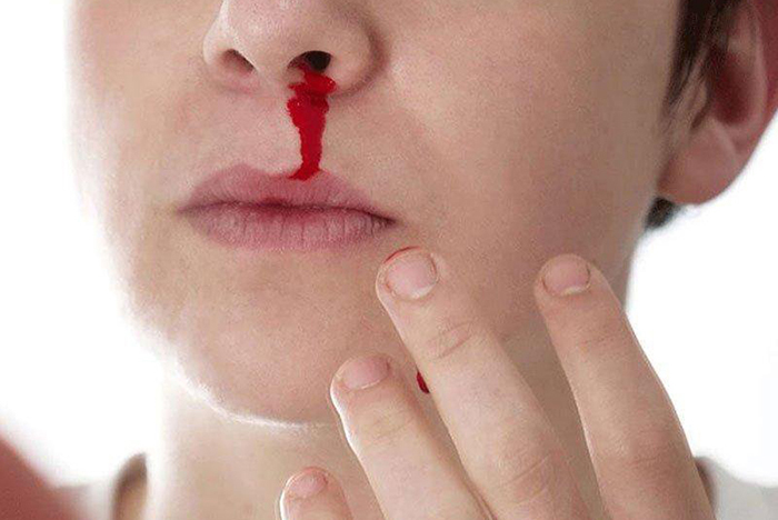 Bệnh nhân có thể bị chảy máu mũi, đau mũi khi nội soi dạ dày qua đường mũi nhưng không nguy hiểm.