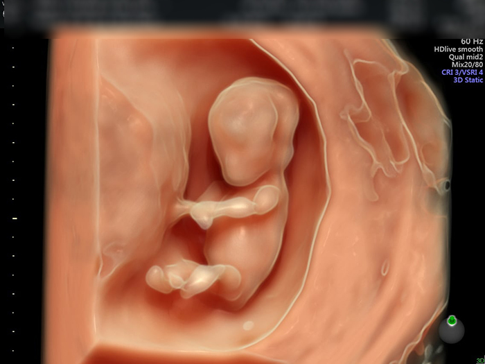 Não bộ của thai nhi 12 tuần tuổi đã phân chia rõ 2 bán cầu