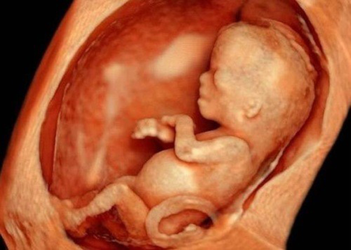 Thai nhi 22 tuần có hình dạng em bé sơ sinh