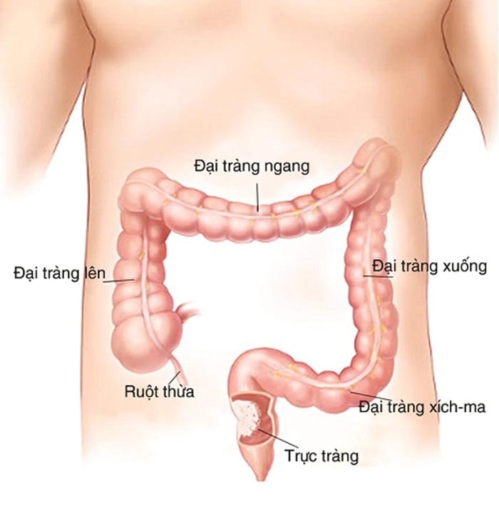 Vị trí của đại tràng sigma trong cơ thể con người