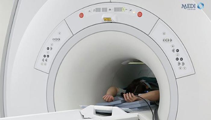 Bên cạnh nội soi thì chụp cộng hưởng từ MRI, siêu âm, chụp CT cũng có thể phát hiện hở van dạ dày