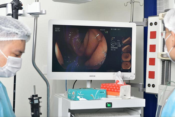 Hình ảnh trên màn hình giúp bác sĩ quan sát và đưa ra chẩn đoán các vấn đề ở dạ dày