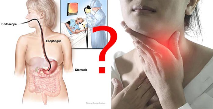 Viêm họng có nội soi dạ dày được không? - Vẫn có thể thực hiện nội soi dạ dày