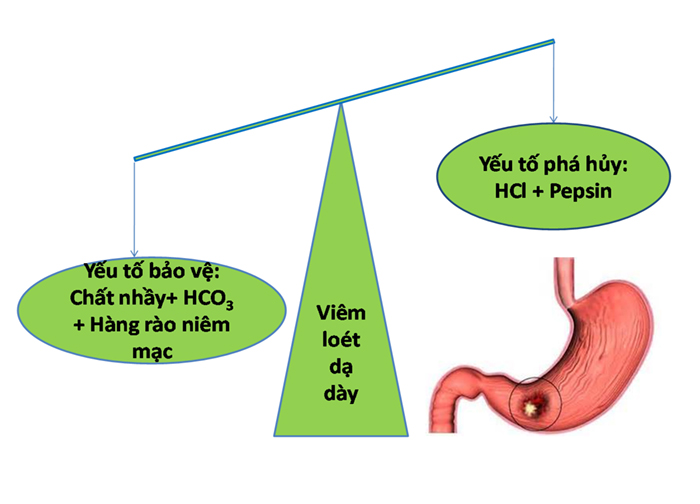 Cơ chế chung các nguyên nhân gây bệnh viêm loét dạ dày cấp