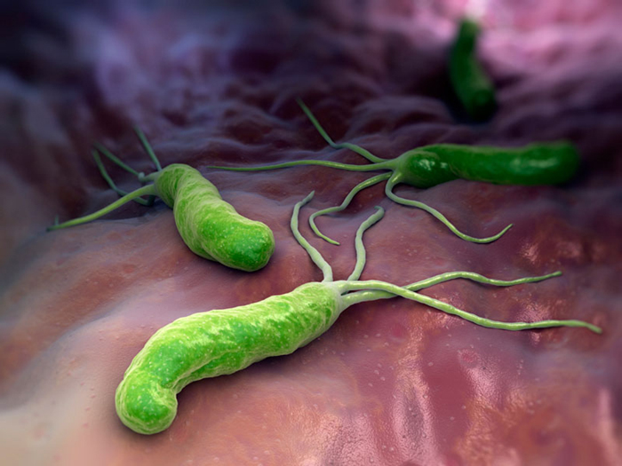 Trường hợp đau dạ dày cấp do nhiễm khuẩn bệnh nhân có thể phải sử dụng kháng sinh