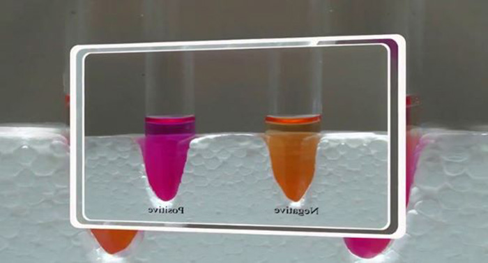 Dung dịch thuốc thử chuyển sang màu hồng là dương tính, giữ nguyên màu vàng là âm tính