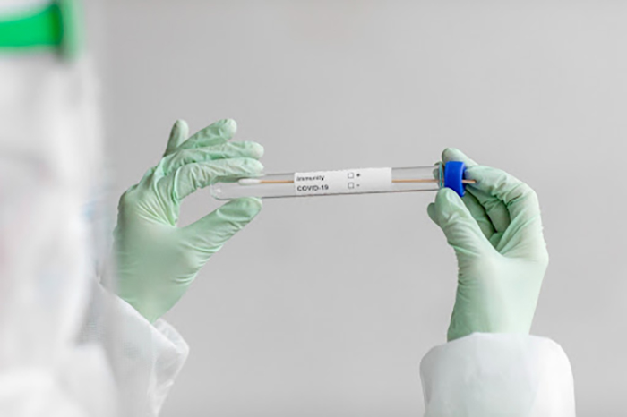 Test nhanh Covid-19 và Test RT-PCR khác nhau như thế nào?