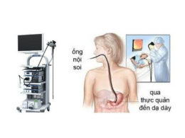 Các bước vệ sinh ống nội soi tiêu hóa theo quy định Bộ Y tế tại Mediplus
