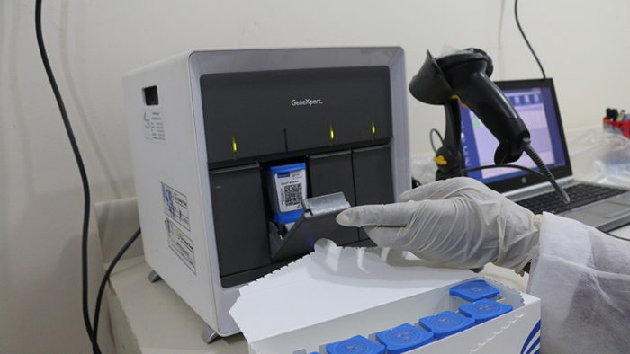 Xét nghiệm Covid-19 Genexpert có bản chất tương đương với RT-PCR nhưng không phổ biến vì chi phí thiết bị cao