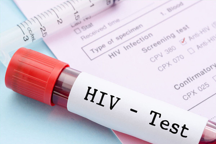 Khám sức khỏe định kỳ ở công ty có xét nghiệm HIV không?
