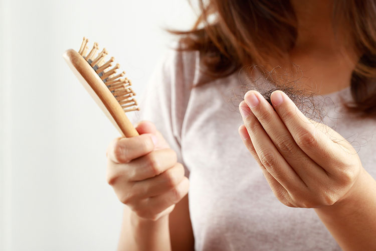 Rụng tóc là một trong những triệu chứng hậu Covid người bệnh có thể gặp