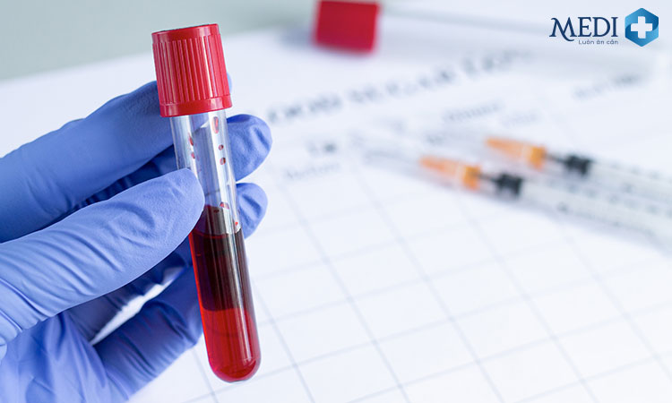 Xét nghiệm máu giúp tầm soát sớm những di chứng hậu COVID có thể gặp phải