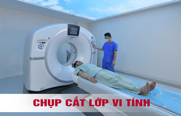 Chụp cắt lớp vi tính (chụp CT) xử lý bằng vi tính