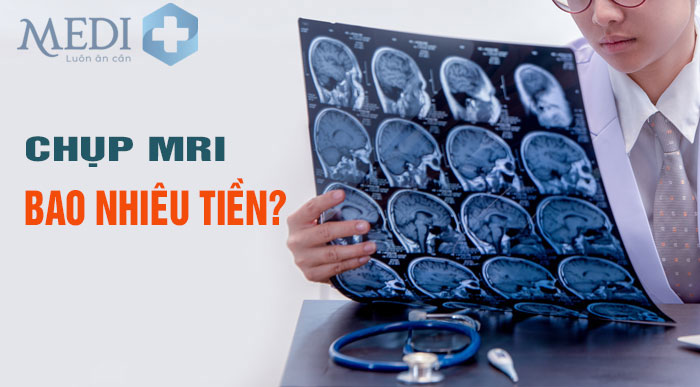 Chi phí chụp MRI phụ thuộc vào nhiều yếu tố khách quan khác nhau
