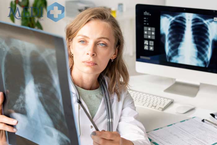 Nhiều bệnh lý tại phổi nếu không được chẩn đoán sớm