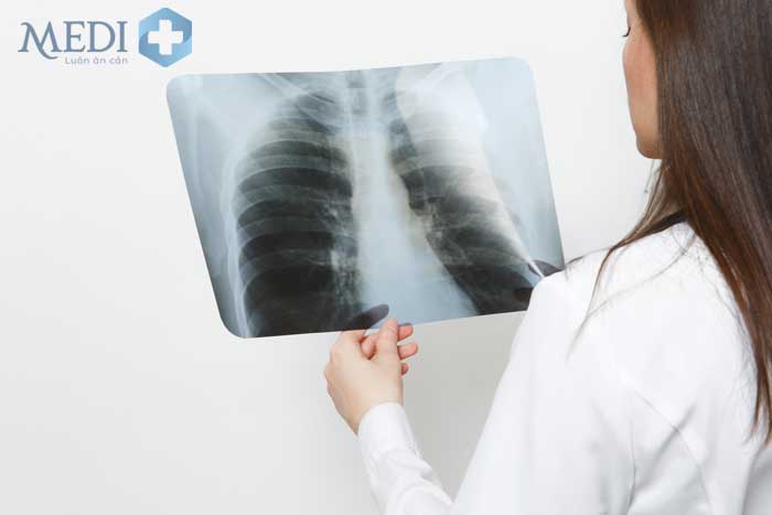 Chụp MRI phổi giúp đánh giá các chức năng phức tạp