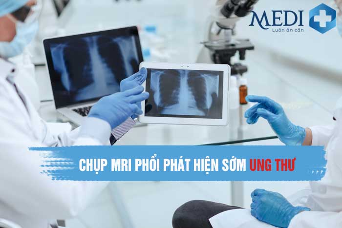 Chụp MRI phổi chẩn đoán sớm bệnh Ung thư phổi