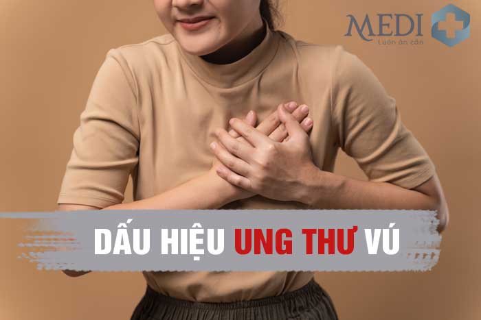 Một số các biểu hiện đau tức ngực có thể là dấu hiệu cảnh báo sớm ung thư vú.