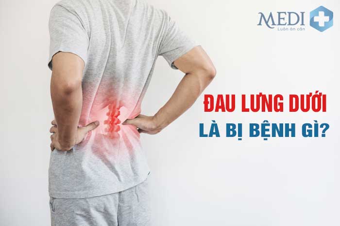 Đau lưng dưới gần hông, biểu hiện của nhiều bệnh lý cần lưu ý