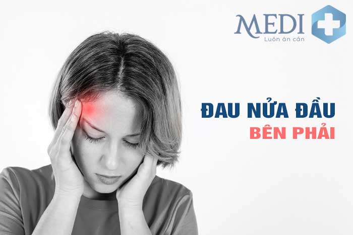 Đau nửa đầu bên phải cảnh báo tiềm ẩn nhiều bệnh lý nguy hiểm