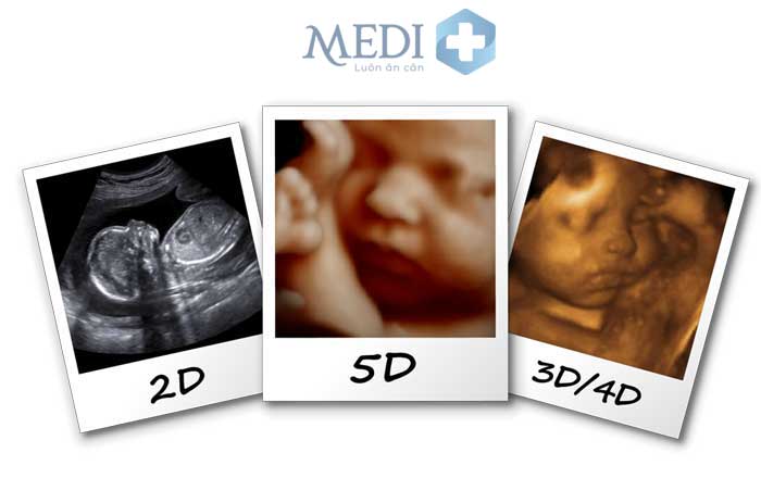 Siêu âm 5D có hại không, có ảnh hưởng đến thai nhi?