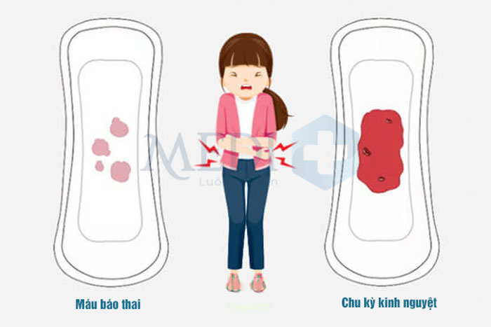 Máu báo thai và kinh nguyệt khác nhau như thế nào?