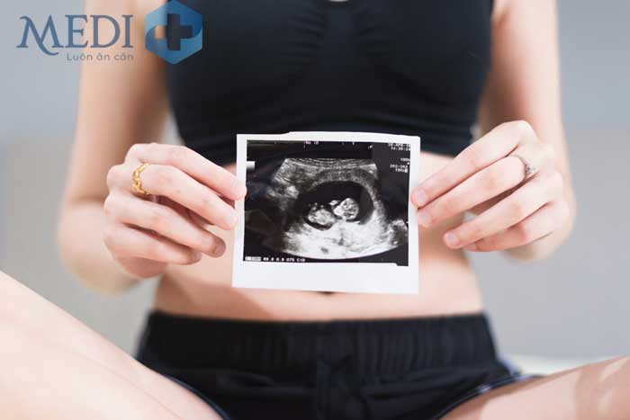 Siêu âm thai 11-12 tuần tuổi xác định vị trí của thai