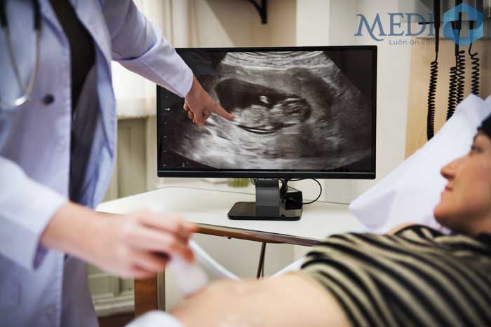 Siêu âm thai theo dõi sự phát triển của thai nhi theo từng giai đoạn