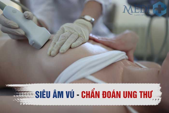 Siêu âm tuyến vú có phát hiện ung thư và có chính xác không?