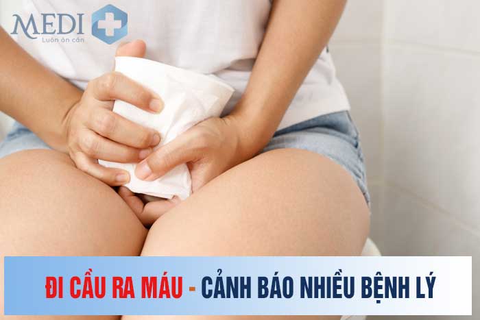 Tình trạng đi ngoài ra máu tươi có thể là cảnh báo của nhiều bệnh lý