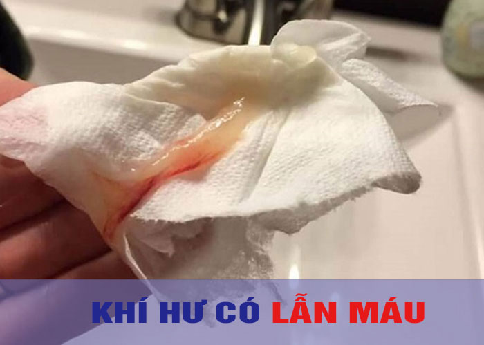 Khí hư có máu ra kèm theo chị em đang bị bệnh?