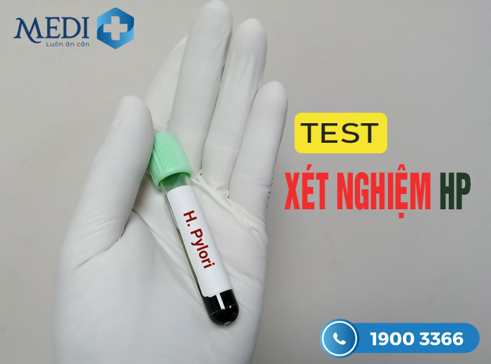 Xét nghiệm HP (test HP) dạ dày, Khi nào thì nên thực hiện?