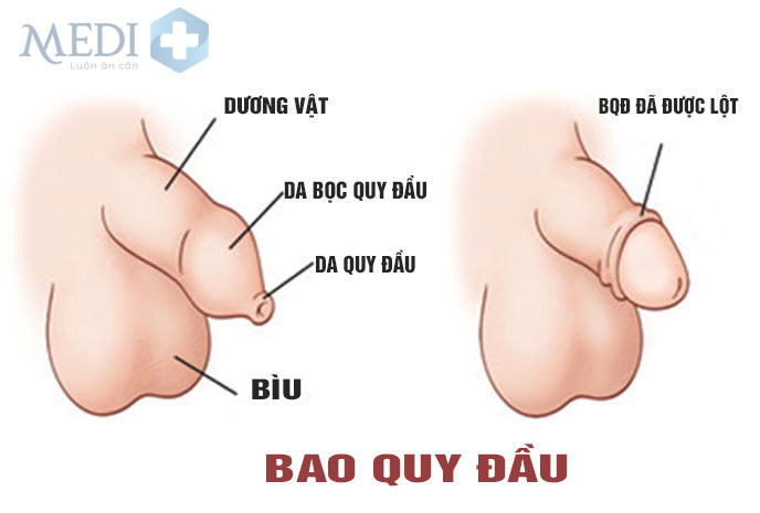 Bao quy đầu là gì? Các bệnh thường gặp về Bao quy đầu 