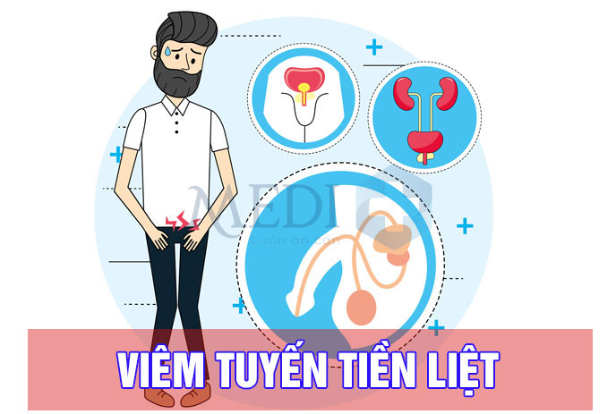 Viêm tuyến tiền liệt – Rối loạn tiết niệu sinh dục nam