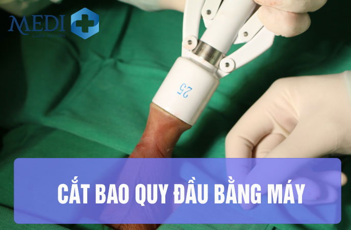 Cắt bao quy đầu hiện đại nhanh chóng thẩm mỹ không đau